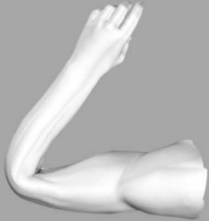 Bending: elbow collapse